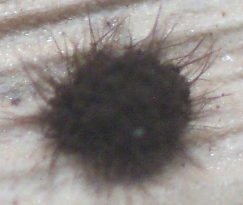 macrostoma