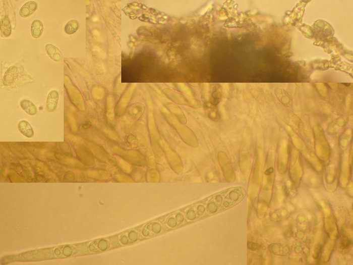 macrostoma