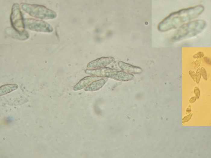 macrostoma