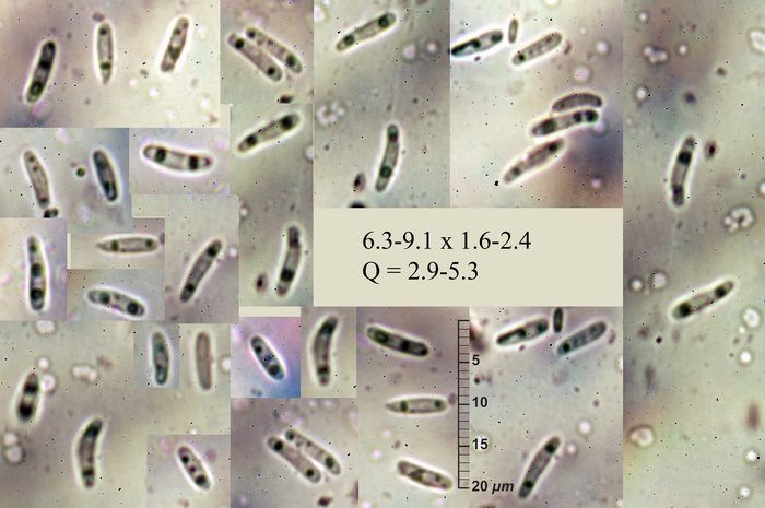 macrostoma