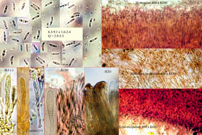 macrostoma