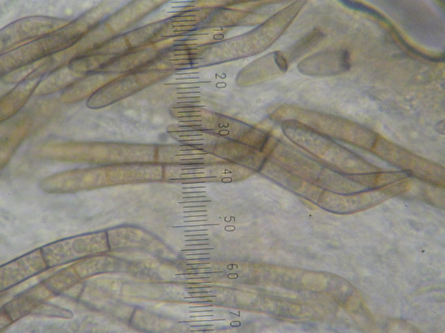 macrostoma