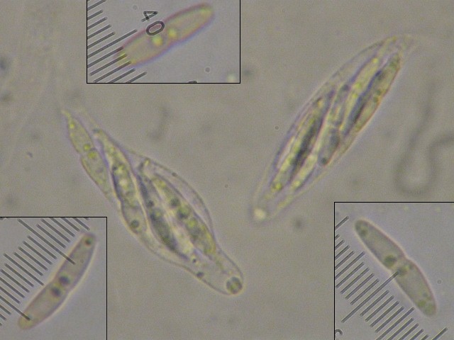 macrostoma