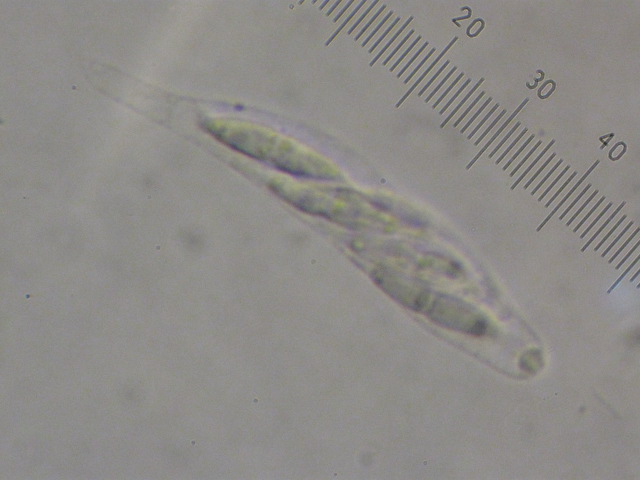 macrostoma