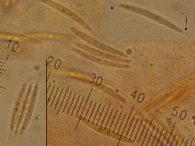 macrostoma