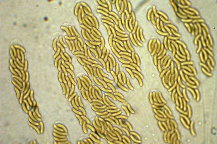 macrostoma