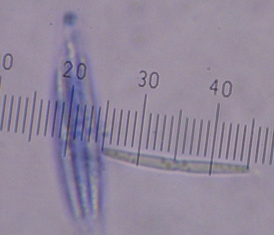 macrostoma