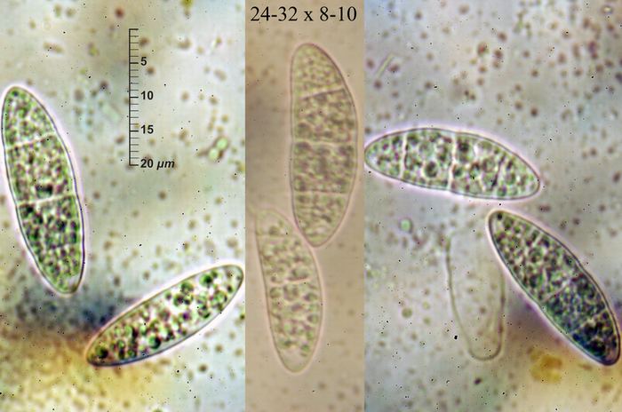 macrostoma