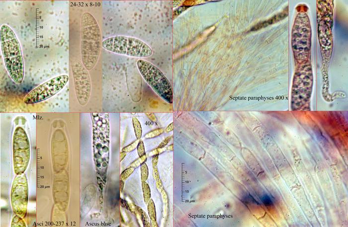 macrostoma