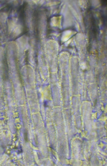 macrostoma