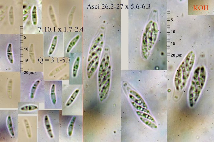 macrostoma
