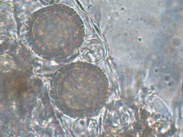 macrostoma