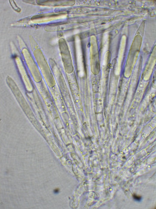 macrostoma