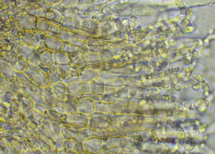 macrostoma