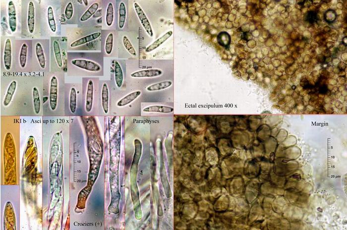 macrostoma