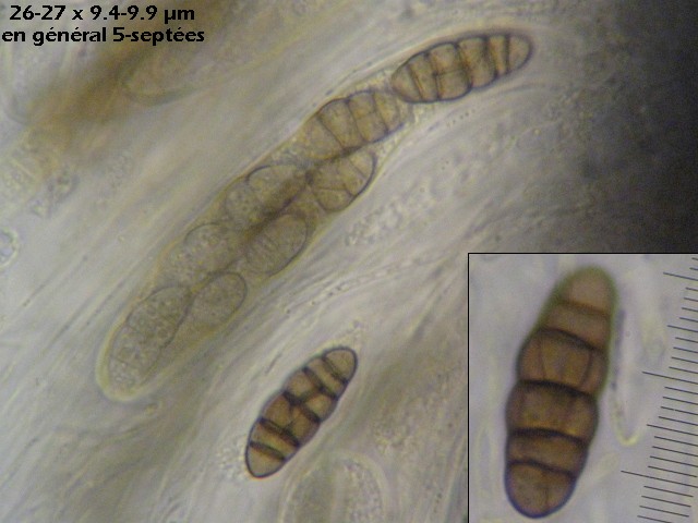 macrostoma