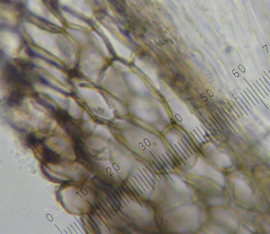 macrostoma
