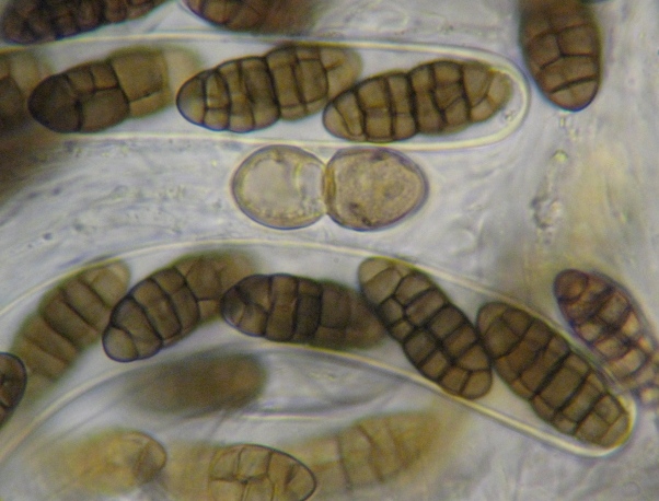 macrostoma