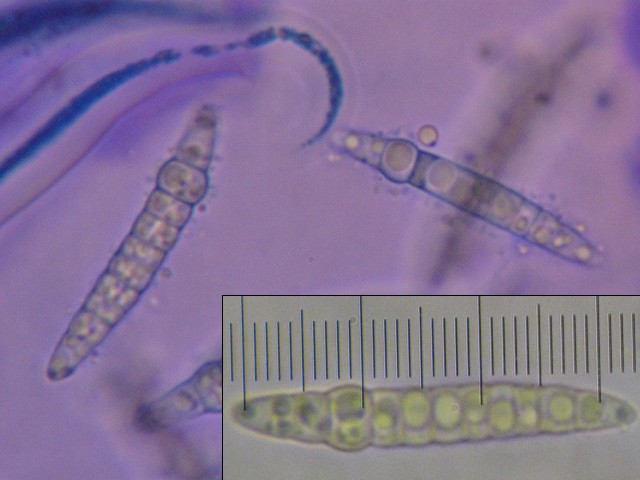 macrostoma
