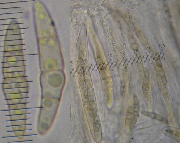 macrostoma