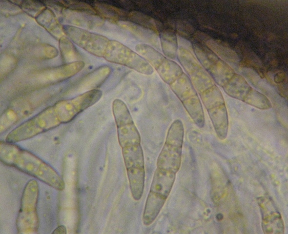 macrostoma