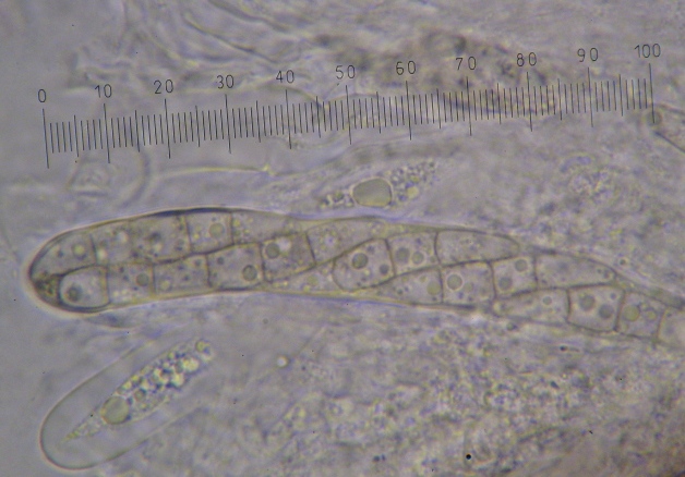 macrostoma