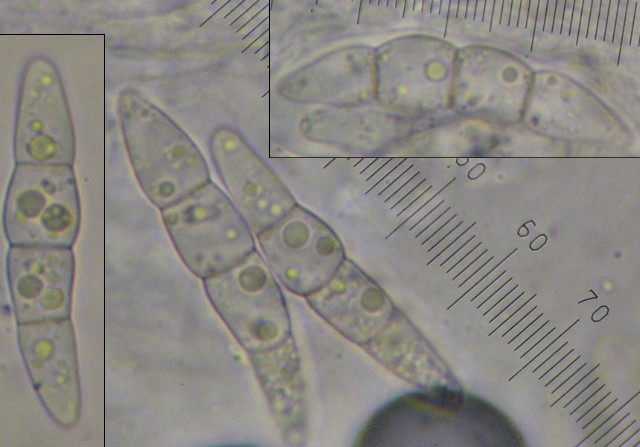 macrostoma