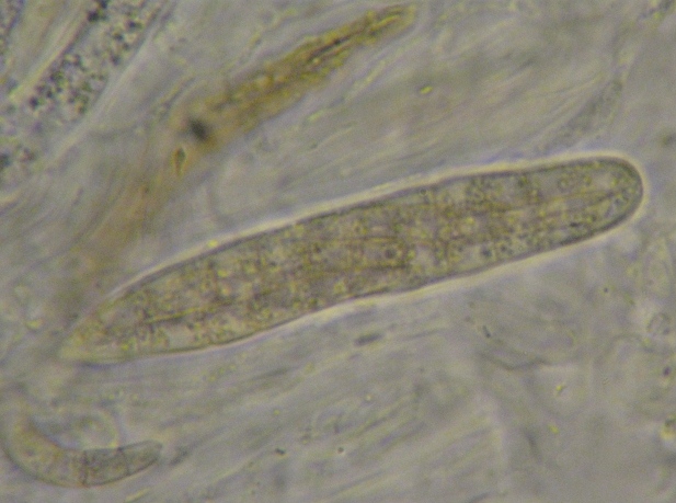 macrostoma