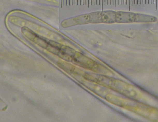 macrostoma