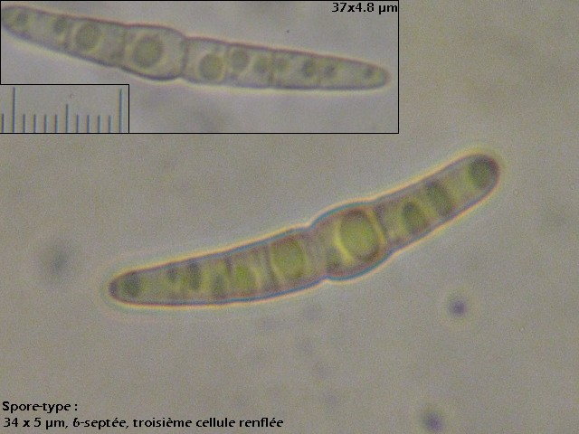 macrostoma