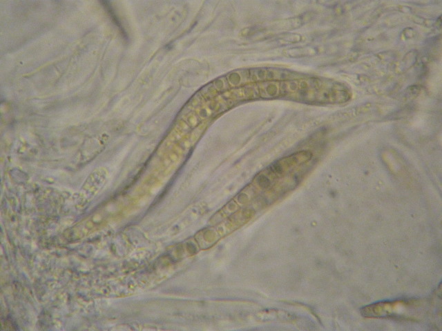 macrostoma