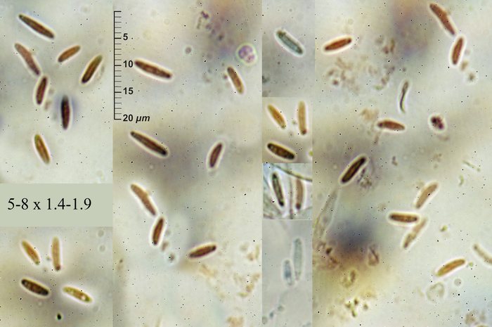 macrostoma