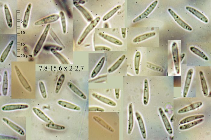 macrostoma