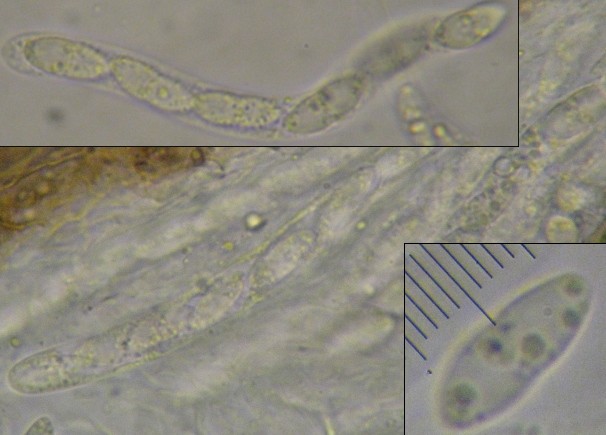 macrostoma