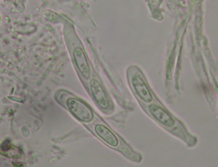 macrostoma