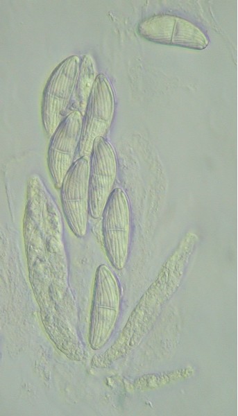 macrostoma