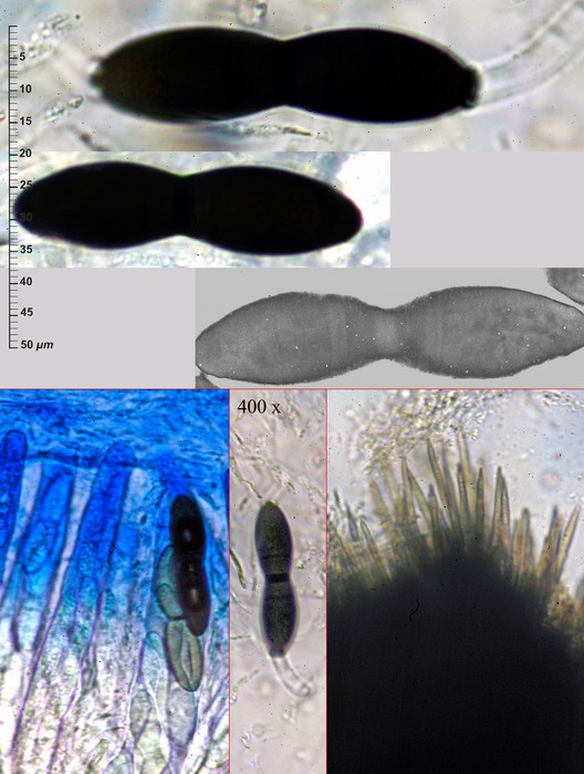 macrostoma