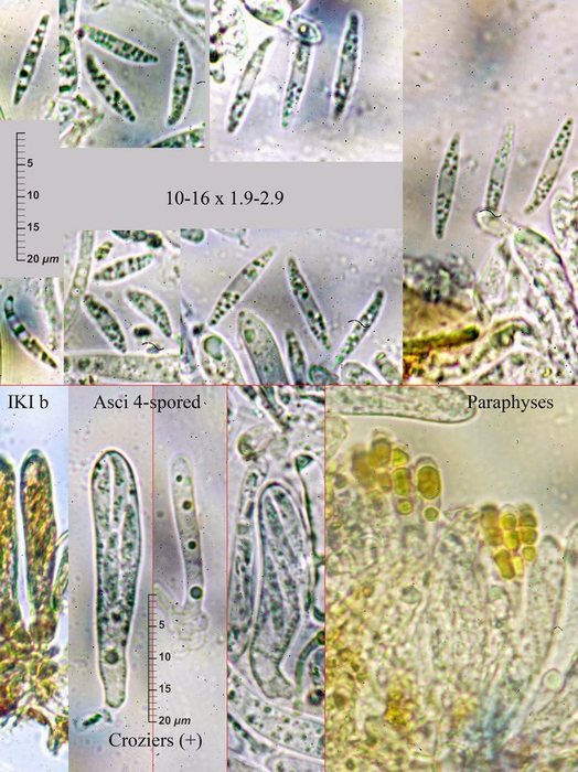 macrostoma