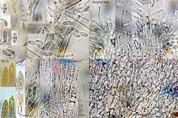 macrostoma