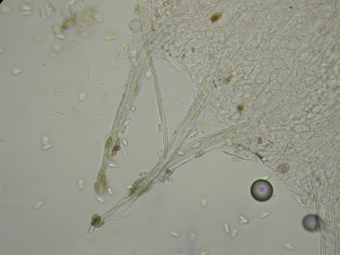 macrostoma