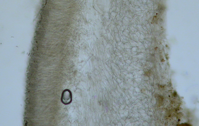 macrostoma