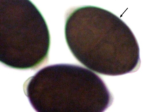 macrostoma