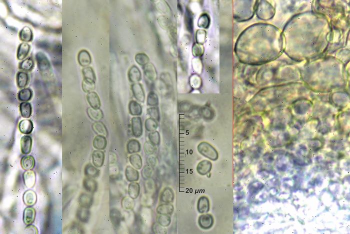 macrostoma