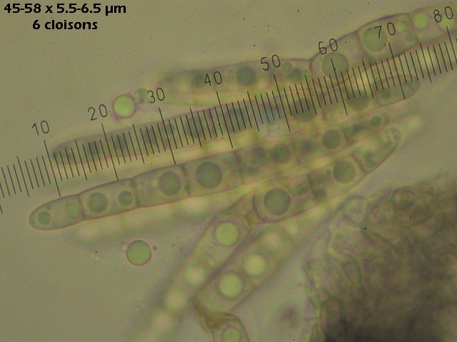 macrostoma