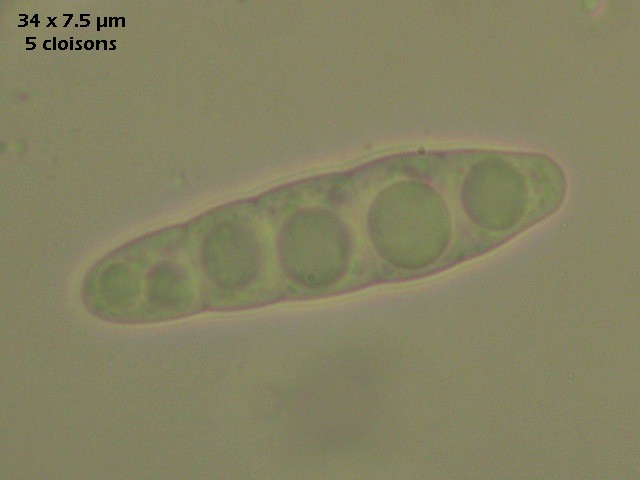 macrostoma