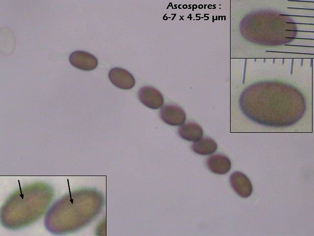 macrostoma