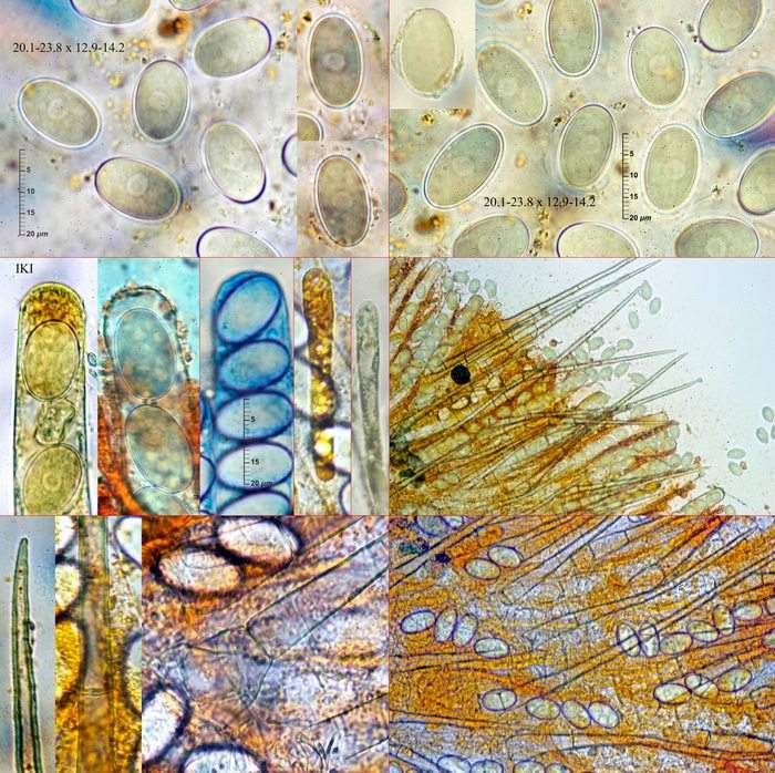 macrostoma