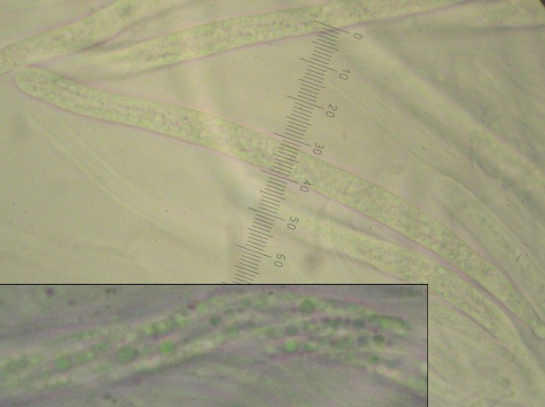 macrostoma