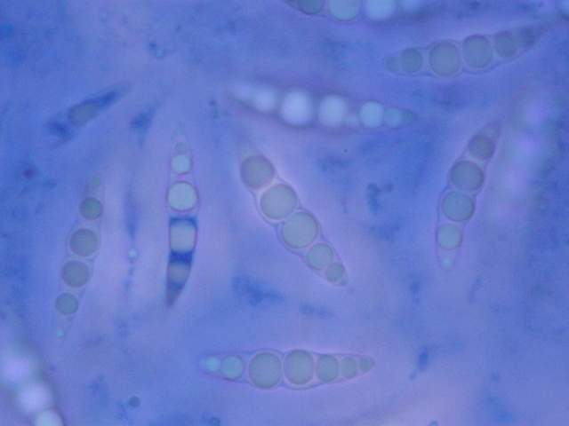 macrostoma