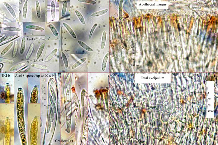 macrostoma